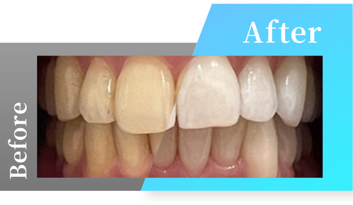 Before・Afterの写真