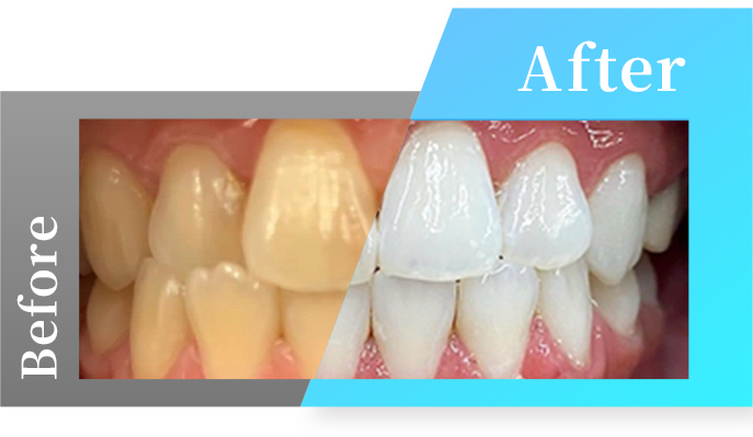Before・Afterの写真