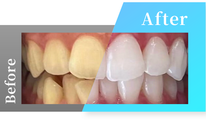 Before・Afterの写真