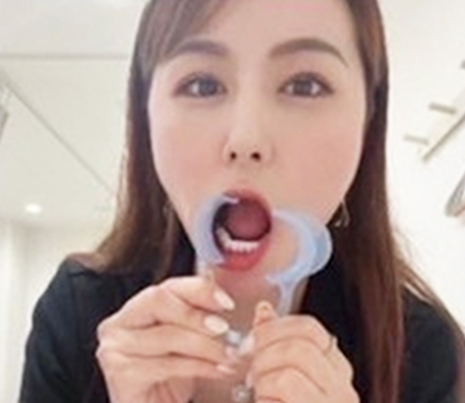 マウスピース装着している写真